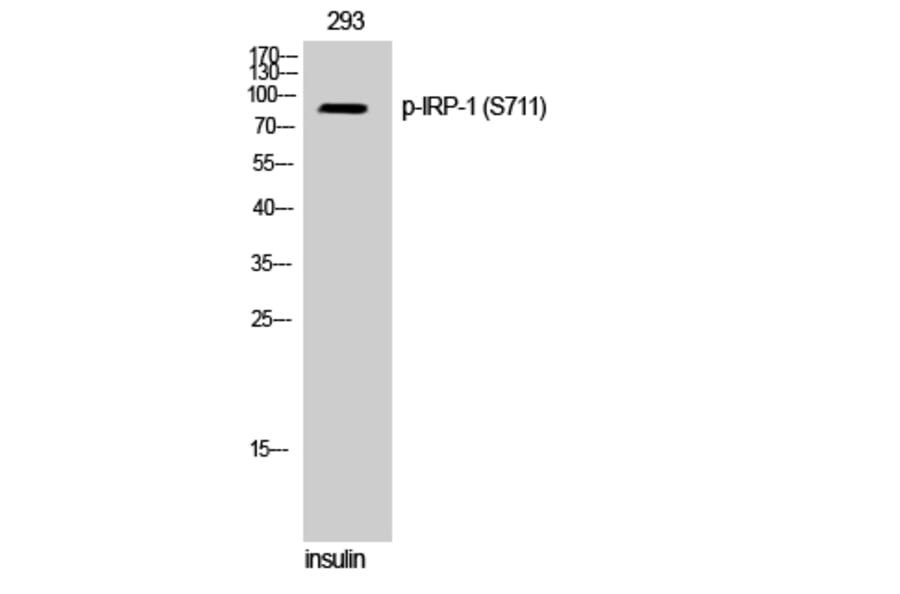 Western Blot - Anti-IREB1 (phospho Ser711) Antibody (A1075) - Antibodies.com