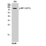 Western Blot - Anti-IREB1 (phospho Ser711) Antibody (A1075) - Antibodies.com