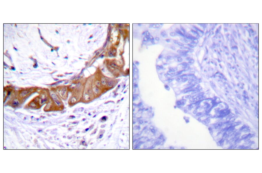 Immunohistochemistry - Anti-IRAK1 (phospho Thr100) Antibody (A1073) - Antibodies.com
