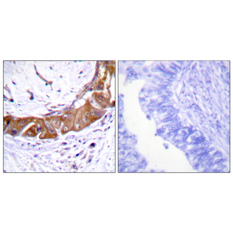 Immunohistochemistry - Anti-IRAK1 (phospho Thr100) Antibody (A1073) - Antibodies.com