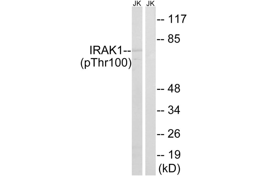 Western Blot - Anti-IRAK1 (phospho Thr100) Antibody (A1073) - Antibodies.com