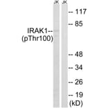 Western Blot - Anti-IRAK1 (phospho Thr100) Antibody (A1073) - Antibodies.com