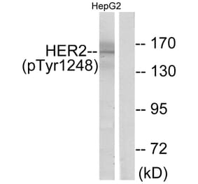 Western Blot - Anti-HER2 (phospho Tyr1248) Antibody (A7104) - Antibodies.com