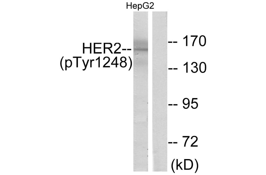 Western Blot - Anti-HER2 (phospho Tyr1248) Antibody (A7104) - Antibodies.com