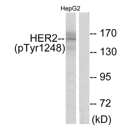 Western Blot - Anti-HER2 (phospho Tyr1248) Antibody (A7104) - Antibodies.com