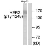 Western Blot - Anti-HER2 (phospho Tyr1248) Antibody (A7104) - Antibodies.com