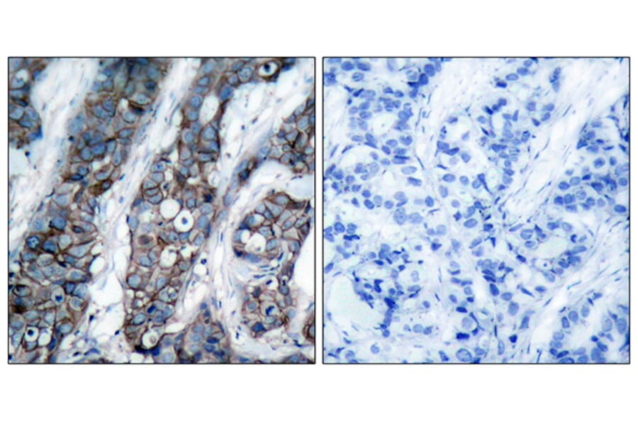 Immunohistochemistry - Anti-HER2 (phospho Tyr1248) Antibody (A7104) - Antibodies.com
