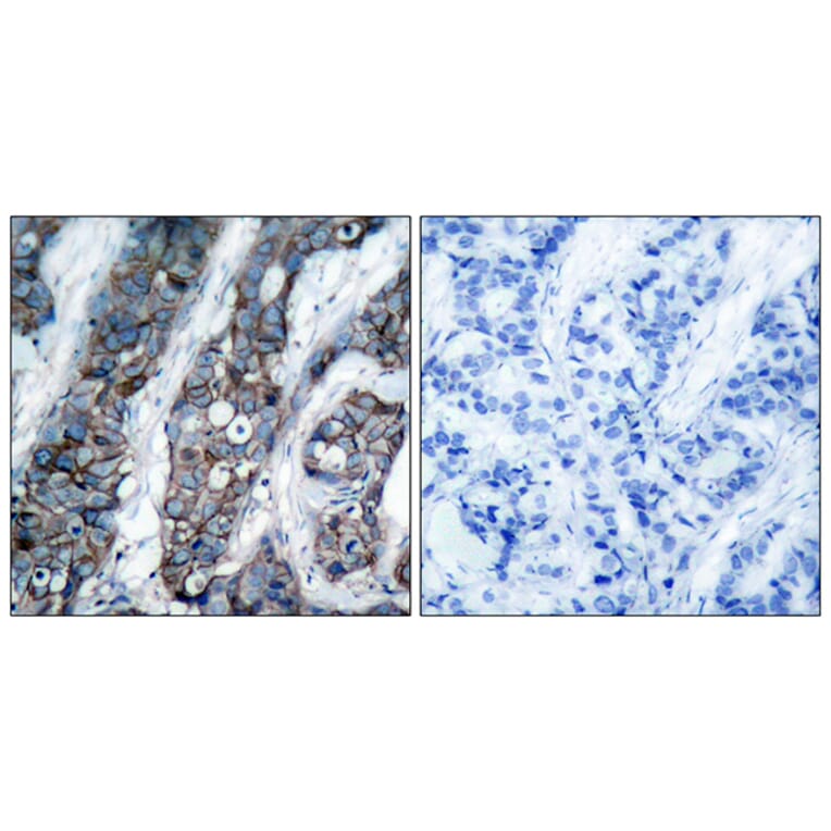 Immunohistochemistry - Anti-HER2 (phospho Tyr1248) Antibody (A7104) - Antibodies.com