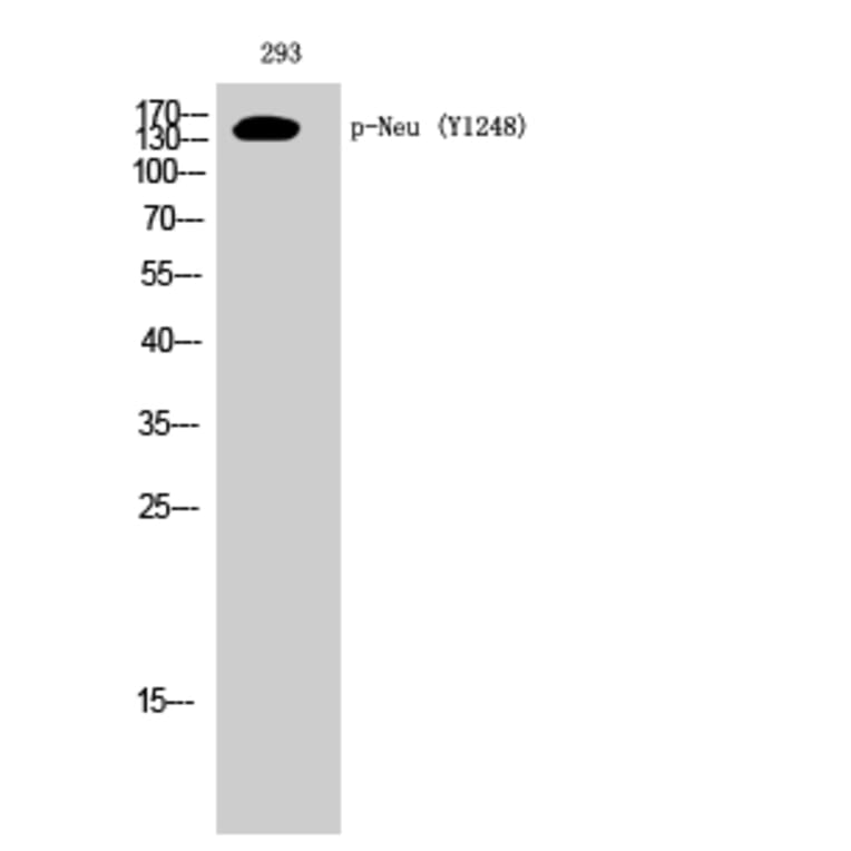 Western Blot - Anti-HER2 (phospho Tyr1248) Antibody (A7104) - Antibodies.com