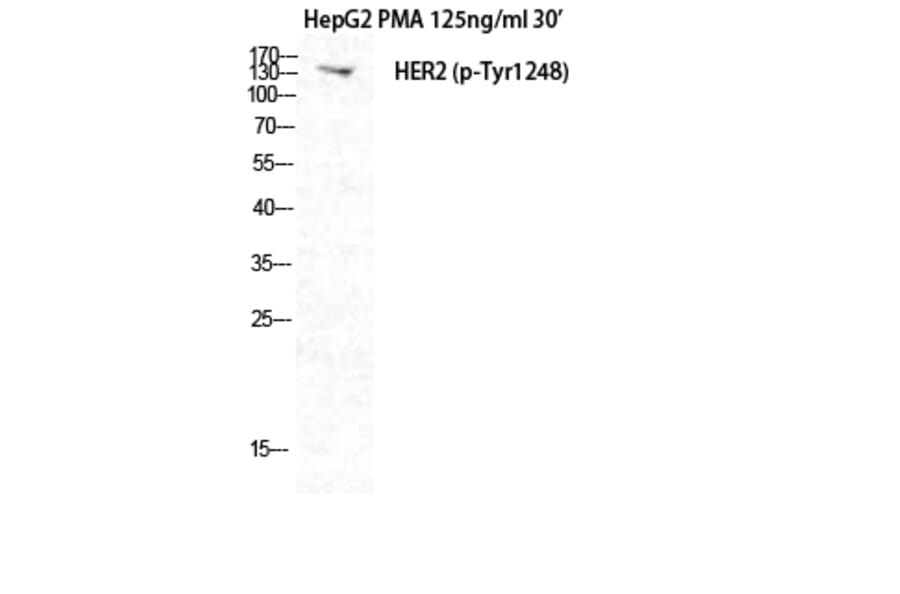Western Blot - Anti-HER2 (phospho Tyr1248) Antibody (A7104) - Antibodies.com