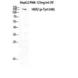 Western Blot - Anti-HER2 (phospho Tyr1248) Antibody (A7104) - Antibodies.com