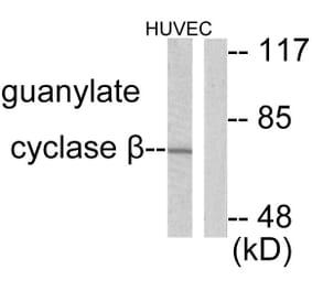 Western Blot - Anti-Guanylate Cyclase beta Antibody (C0219) - Antibodies.com