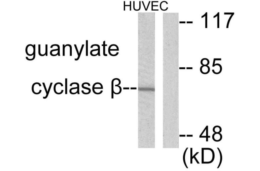 Western Blot - Anti-Guanylate Cyclase beta Antibody (C0219) - Antibodies.com