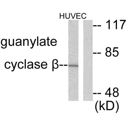 Western Blot - Anti-Guanylate Cyclase beta Antibody (C0219) - Antibodies.com