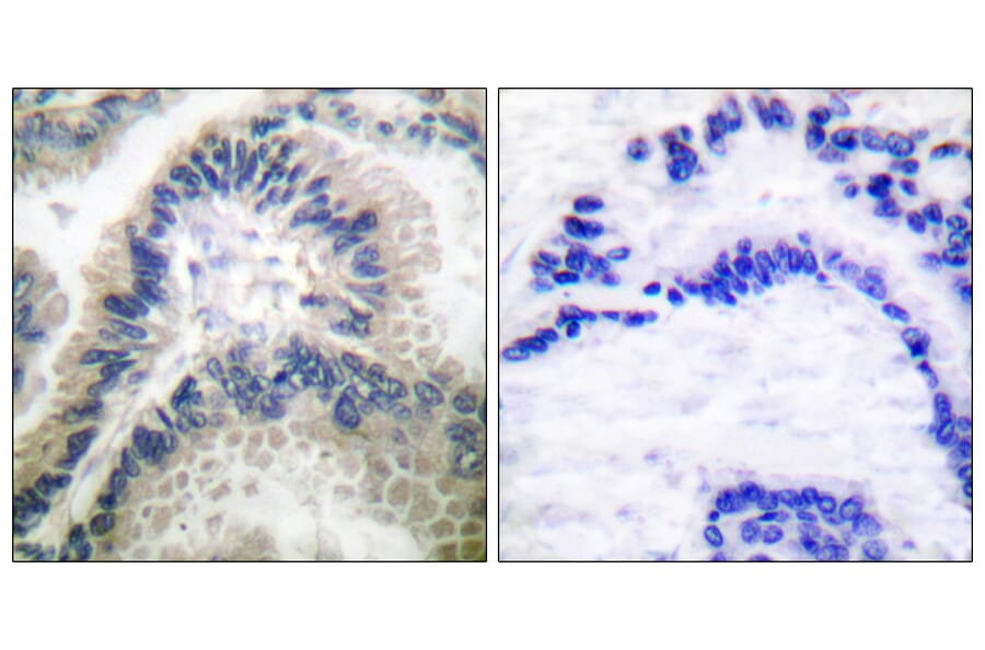 Immunohistochemistry - Anti-Guanylate Cyclase beta Antibody (C0219) - Antibodies.com