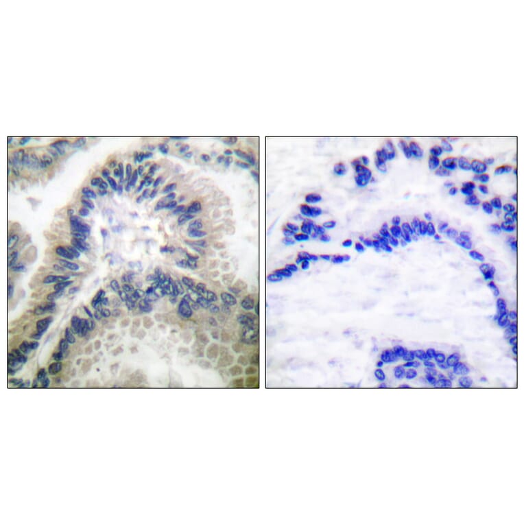 Immunohistochemistry - Anti-Guanylate Cyclase beta Antibody (C0219) - Antibodies.com