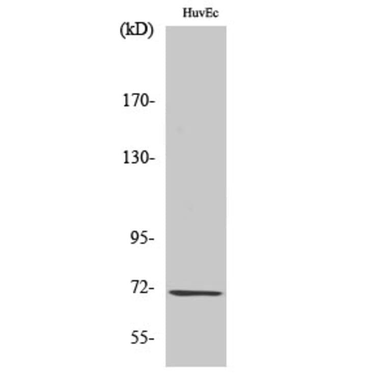 Western Blot - Anti-Guanylate Cyclase beta Antibody (C0219) - Antibodies.com
