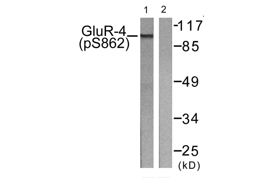 Western Blot - Anti-GluR4 (phospho Ser862) Antibody (A0936) - Antibodies.com