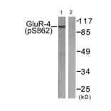 Western Blot - Anti-GluR4 (phospho Ser862) Antibody (A0936) - Antibodies.com