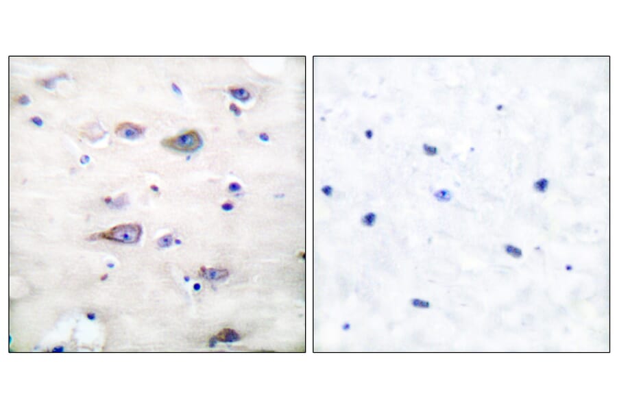 Immunohistochemistry - Anti-GluR2 (phospho Ser880) Antibody (A7096) - Antibodies.com