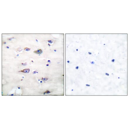 Immunohistochemistry - Anti-GluR2 (phospho Ser880) Antibody (A7096) - Antibodies.com