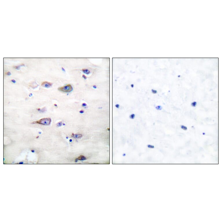 Immunohistochemistry - Anti-GluR2 (phospho Ser880) Antibody (A7096) - Antibodies.com
