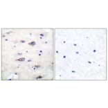 Immunohistochemistry - Anti-GluR2 (phospho Ser880) Antibody (A7096) - Antibodies.com