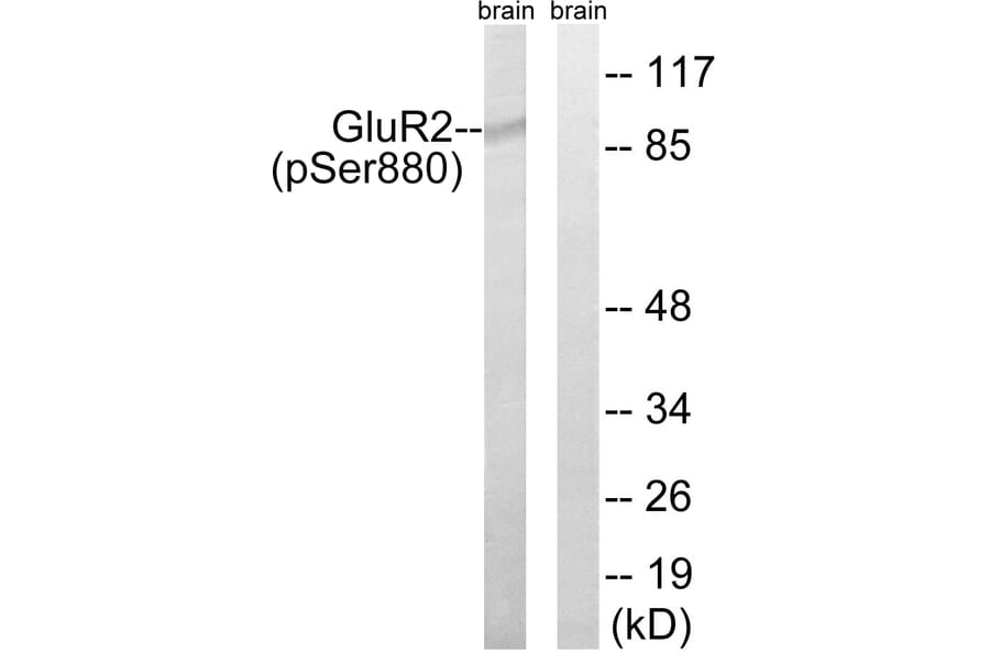 Western Blot - Anti-GluR2 (phospho Ser880) Antibody (A7096) - Antibodies.com