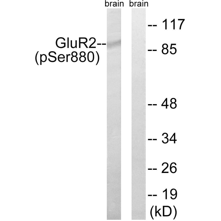 Western Blot - Anti-GluR2 (phospho Ser880) Antibody (A7096) - Antibodies.com