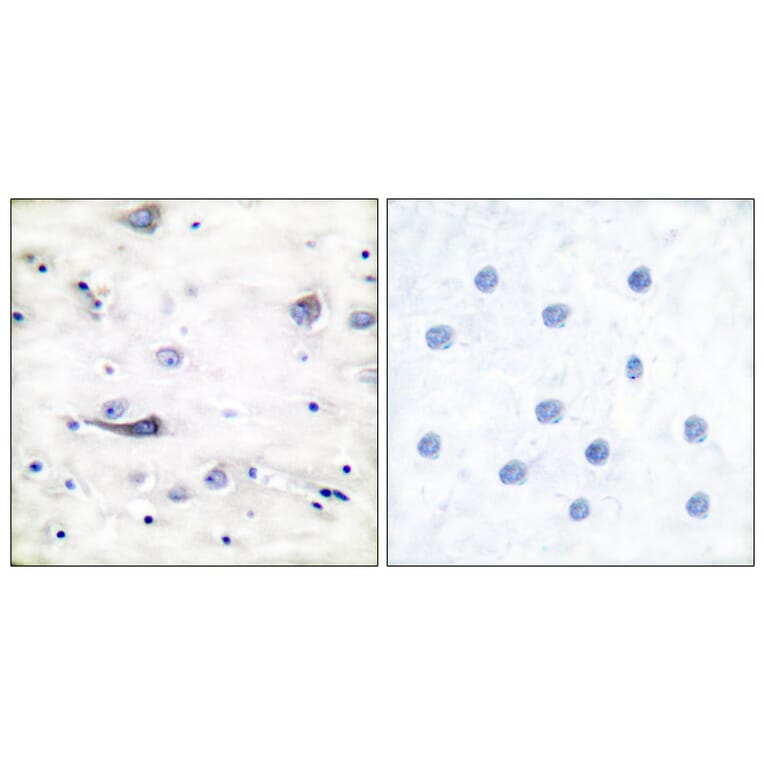 Immunohistochemistry - Anti-GluR1 (phospho Ser863) Antibody (A7095) - Antibodies.com