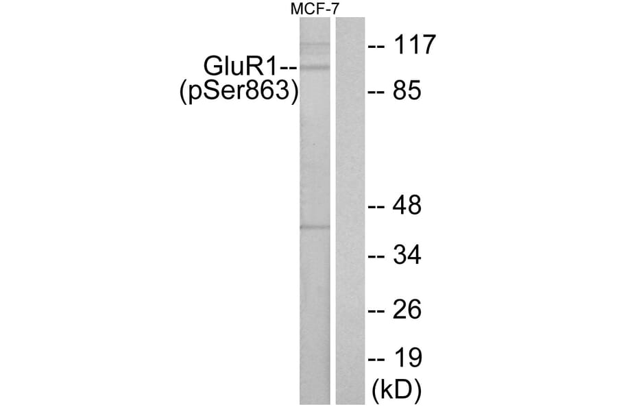 Western Blot - Anti-GluR1 (phospho Ser863) Antibody (A7095) - Antibodies.com