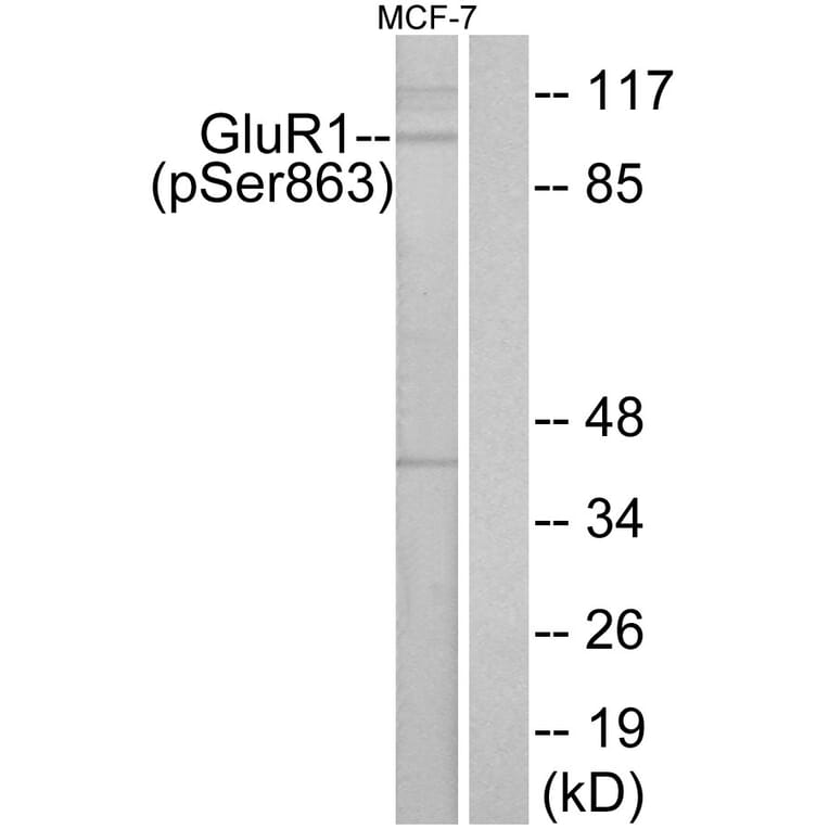 Western Blot - Anti-GluR1 (phospho Ser863) Antibody (A7095) - Antibodies.com