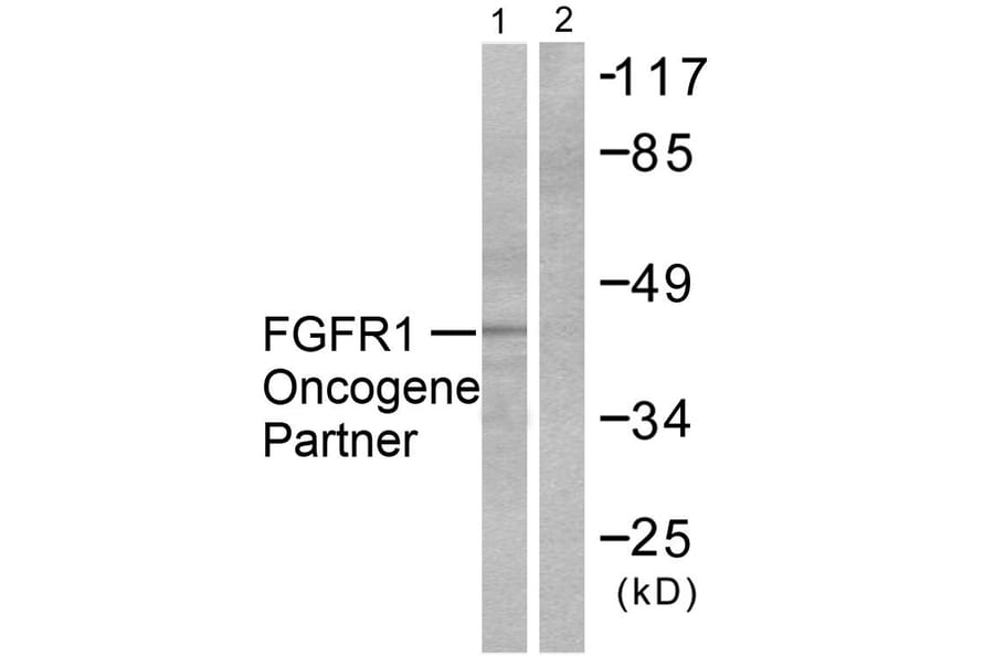 Western Blot - Anti-FGFR1 Oncogene Partner Antibody (C0190) - Antibodies.com