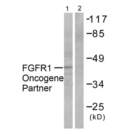 Western Blot - Anti-FGFR1 Oncogene Partner Antibody (C0190) - Antibodies.com