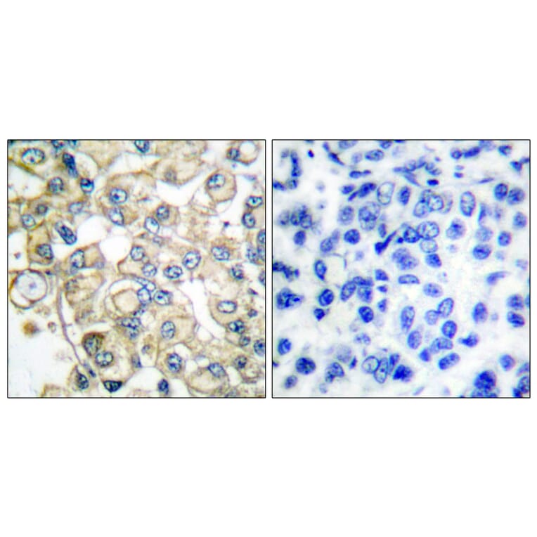 Immunohistochemistry - Anti-FGFR1 Oncogene Partner Antibody (C0190) - Antibodies.com