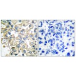 Immunohistochemistry - Anti-FGFR1 Oncogene Partner Antibody (C0190) - Antibodies.com