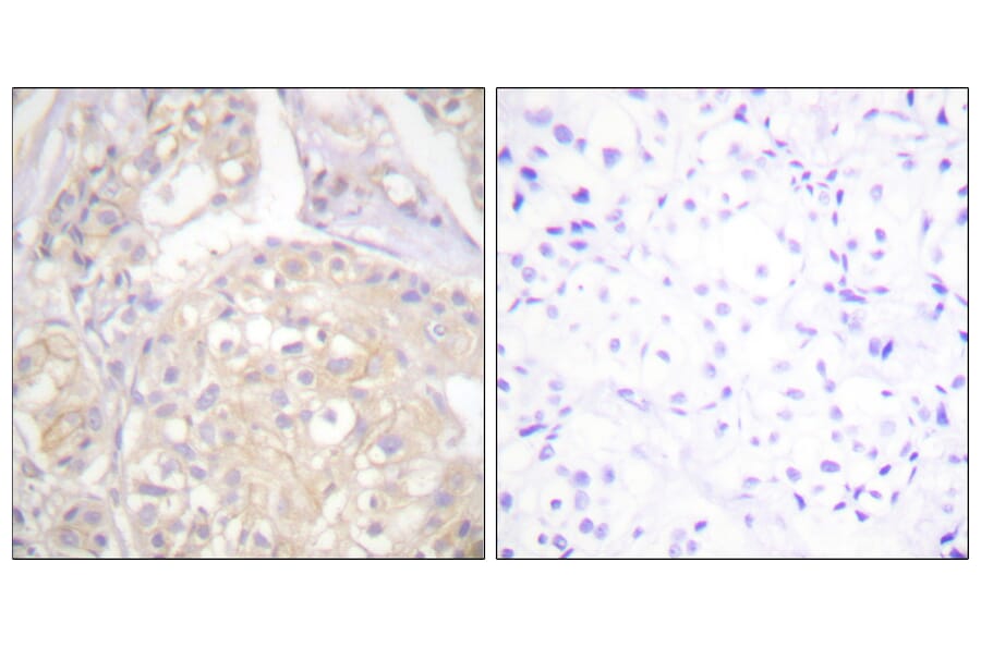 Immunohistochemistry - Anti-FGFR1 (phospho Tyr766) Antibody (A0480) - Antibodies.com