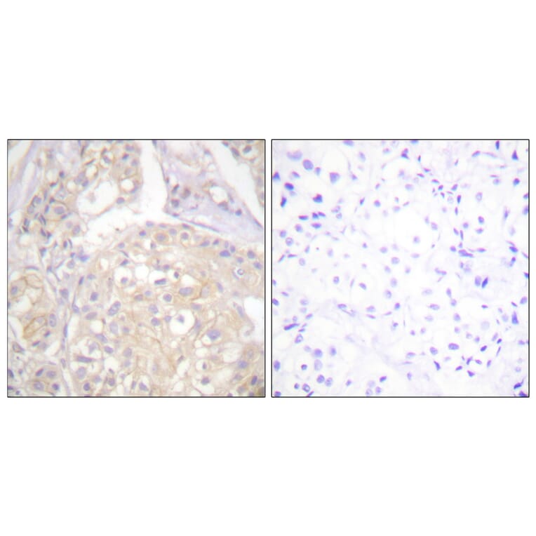Immunohistochemistry - Anti-FGFR1 (phospho Tyr766) Antibody (A0480) - Antibodies.com