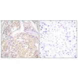 Immunohistochemistry - Anti-FGFR1 (phospho Tyr766) Antibody (A0480) - Antibodies.com