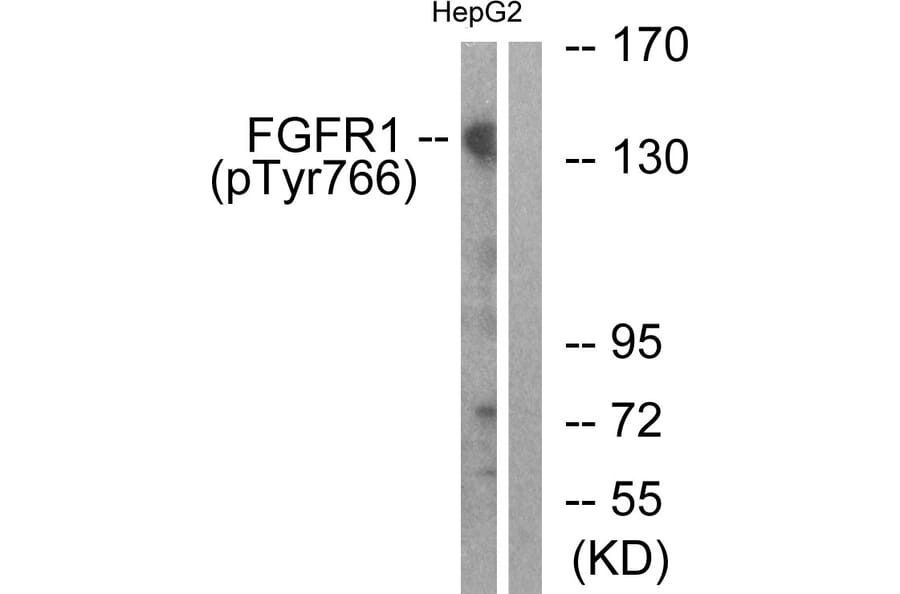 Western Blot - Anti-FGFR1 (phospho Tyr766) Antibody (A0480) - Antibodies.com