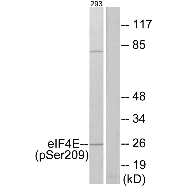 Western Blot - Anti-eIF4E (phospho Ser209) Antibody (A7067) - Antibodies.com