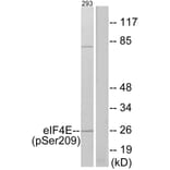 Western Blot - Anti-eIF4E (phospho Ser209) Antibody (A7067) - Antibodies.com