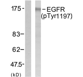 Western Blot - Anti-EGFR (phospho Tyr1197) Antibody (A7064) - Antibodies.com