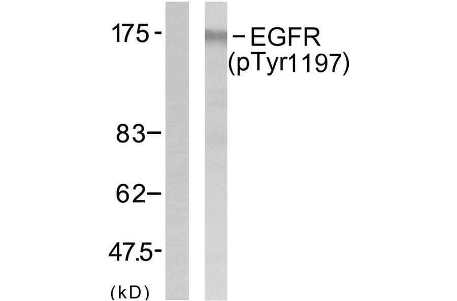 Western Blot - Anti-EGFR (phospho Tyr1197) Antibody (A7064) - Antibodies.com