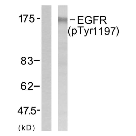 Western Blot - Anti-EGFR (phospho Tyr1197) Antibody (A7064) - Antibodies.com
