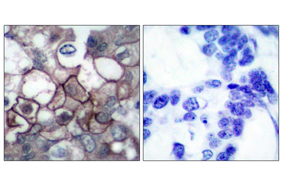 Immunohistochemistry - Anti-EGFR (phospho Tyr1197) Antibody (A7064) - Antibodies.com