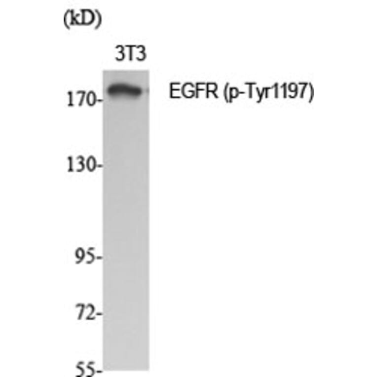 Western Blot - Anti-EGFR (phospho Tyr1197) Antibody (A7064) - Antibodies.com
