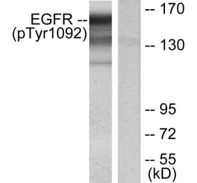 Western Blot - Anti-EGFR (phospho Tyr1092) Antibody (A7061) - Antibodies.com