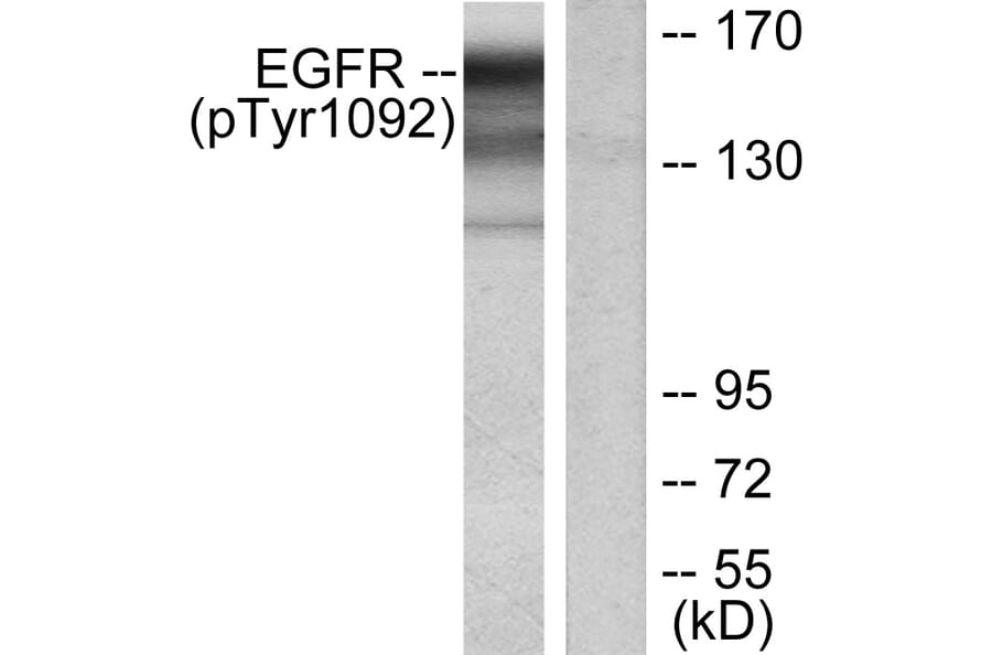 Western Blot - Anti-EGFR (phospho Tyr1092) Antibody (A7061) - Antibodies.com