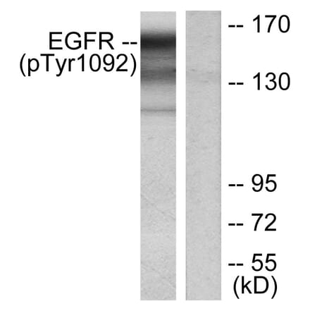 Western Blot - Anti-EGFR (phospho Tyr1092) Antibody (A7061) - Antibodies.com
